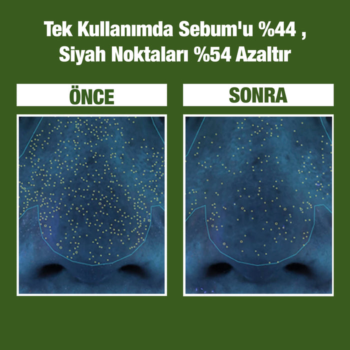 Olyelle™ - Holy Basil Özlü Derin Arındırıcı Köpük Maske
